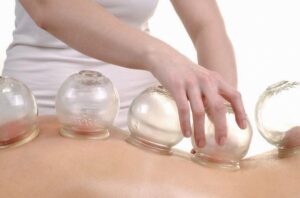 Theramedi Cupping ---45 MIN---